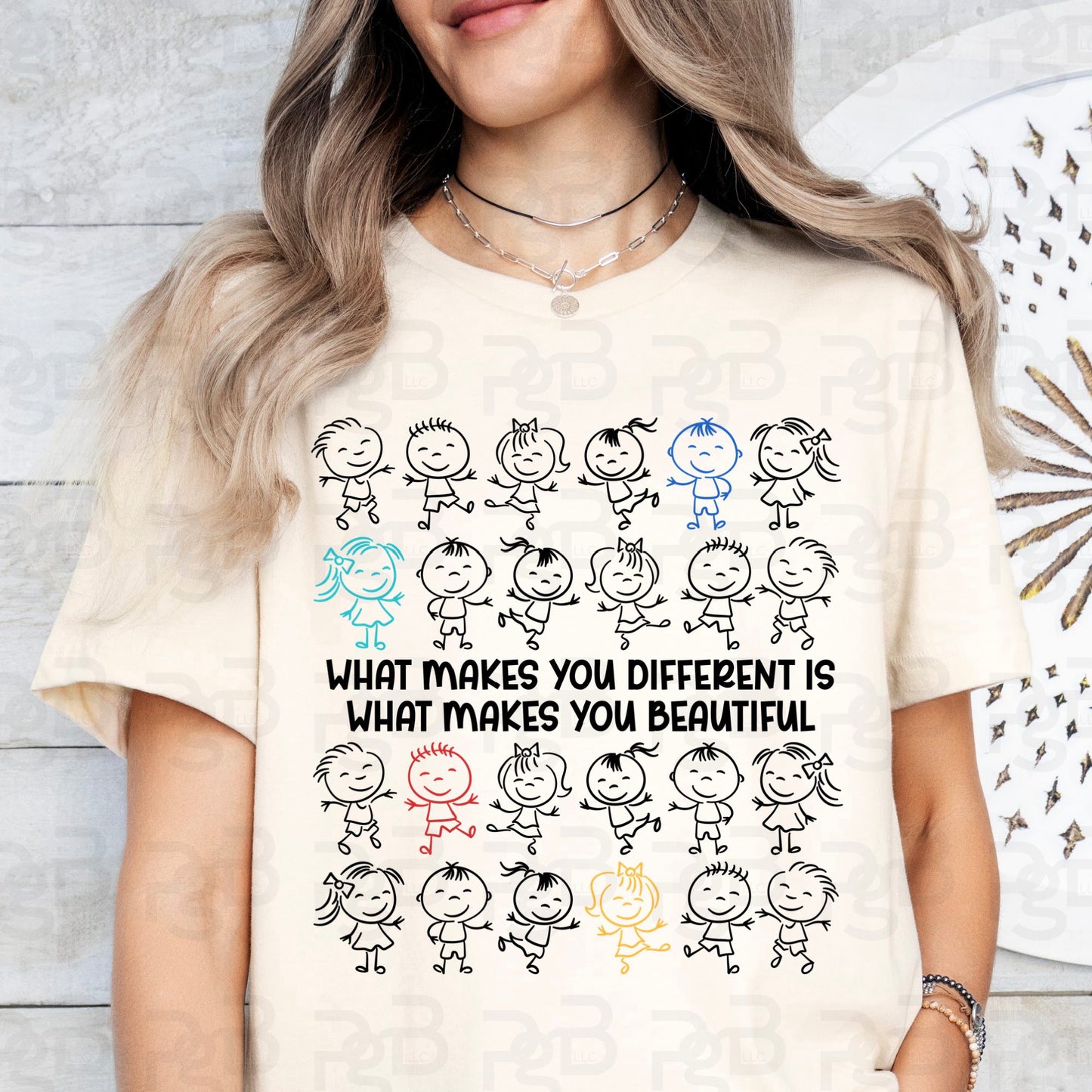 What Makes You Different Is What Makes You Beautiful 07419